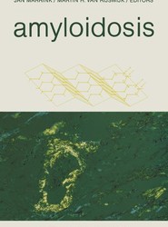 Amyloidosis