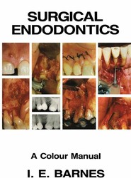 Surgical Endodontics