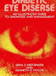 Diabetic Eye Disease