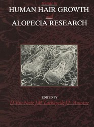 Trends in Human Hair Growth and Alopecia Research