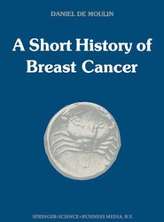 A short history of breast cancer