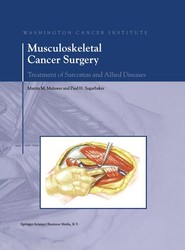 Musculoskeletal Cancer Surgery