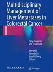 Multidisciplinary Management of Liver Metastases in Colorectal Cancer