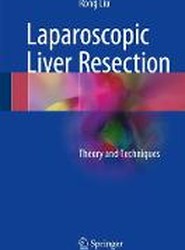 Laparoscopic Liver Resection