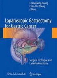 Laparoscopic Gastrectomy for Gastric Cancer