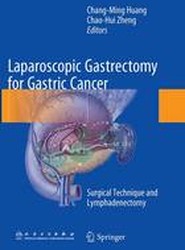 Laparoscopic Gastrectomy for Gastric Cancer