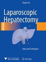 Laparoscopic Hepatectomy