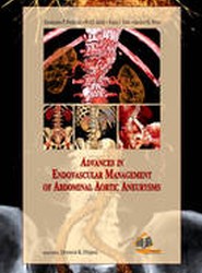 Advances in Endovascular Management of Abdominal Aortic Aneurysms