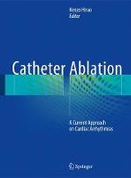 Catheter Ablation