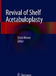 Revival of Shelf Acetabuloplasty