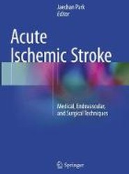 Acute Ischemic Stroke