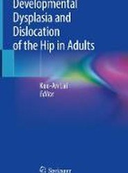 Developmental Dysplasia and Dislocation of the Hip in Adults