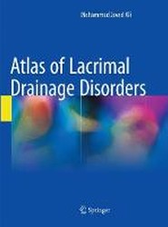 Atlas of Lacrimal Drainage Disorders