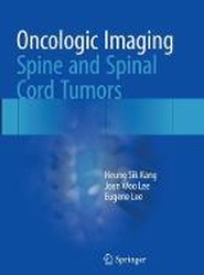 Oncologic Imaging: Spine and Spinal Cord Tumors