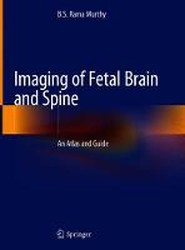 Imaging of Fetal Brain and Spine