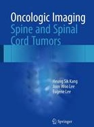 Oncologic Imaging: Spine and Spinal Cord Tumors