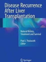 Disease Recurrence After Liver Transplantation