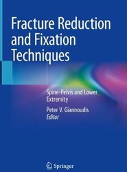 Fracture Reduction and Fixation Techniques