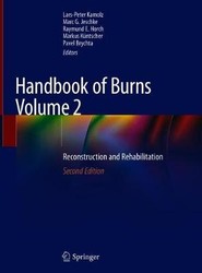 Handbook of Burns Volume 2