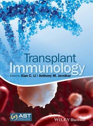 Transplant Immunology