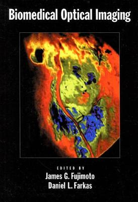 Biomedical Optical Imaging