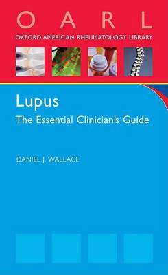 Lupus