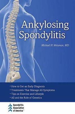 Ankylosing Spondylitis