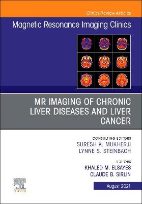 MR Imaging of Chronic Liver Diseases and Liver Cancer, An Issue of Magnetic Resonance Imaging Clinics of North America: Volume 29-3