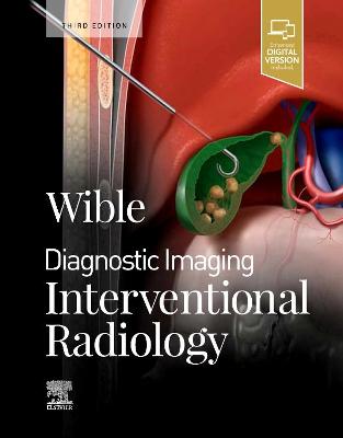 Diagnostic Imaging: Interventional Radiology