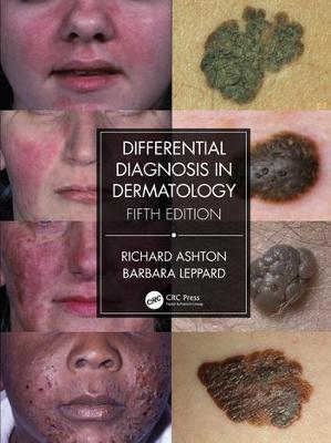 Differential Diagnosis in Dermatology