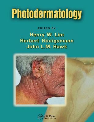Photodermatology