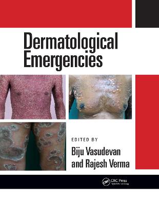 Dermatological Emergencies