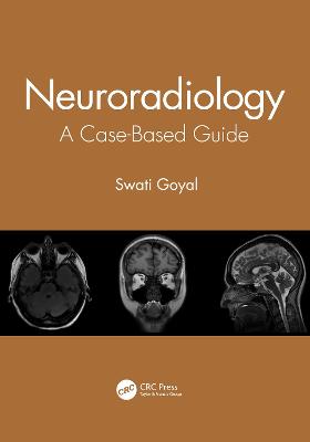 Neuroradiology