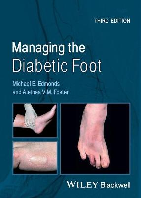Managing the Diabetic Foot 3e
