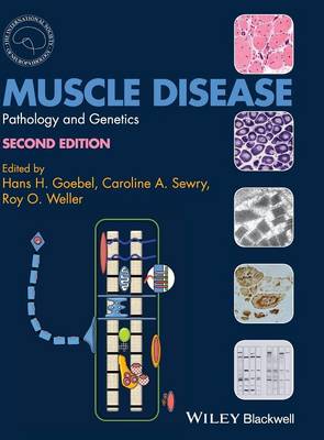 Muscle Disease - Pathology and Genetics