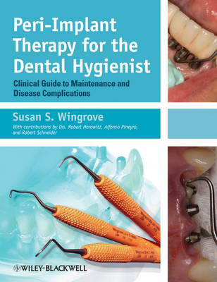 Peri-Implant Therapy for the Dental Hygienist - Clinical Guide to Maintenance and Disease Complications