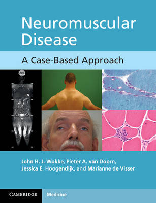 Neuromuscular Disease