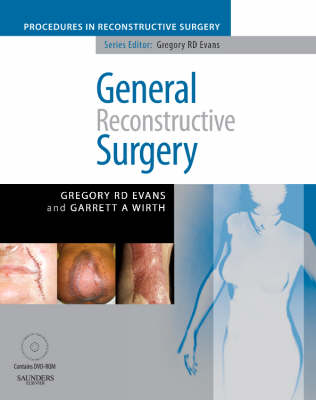 General Reconstructive Surgery