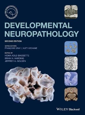Developmental Neuropathology