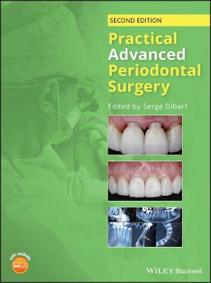Practical Advanced Periodontal Surgery, 2nd 2nd Edition
