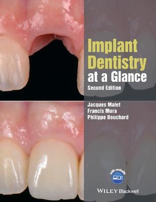 Implant Dentistry at a Glance, 2nd Edition