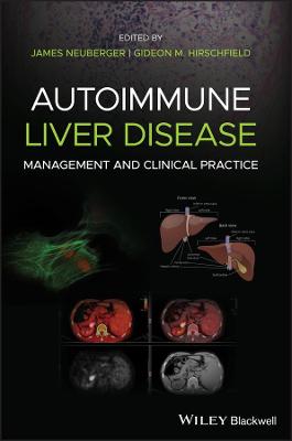 Autoimmune Liver Disease - Management and Clinical Practice