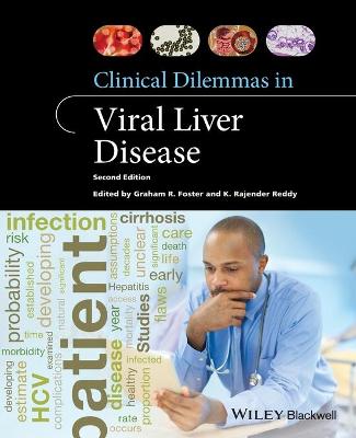 Clinical Dilemmas in Viral Liver Disease 2e