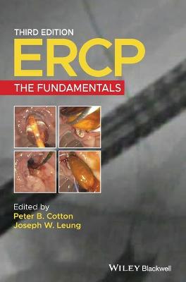 ERCP - The Fundamentals 3e
