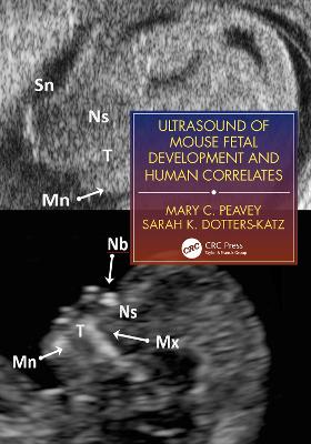 Ultrasound of Mouse Fetal Development and Human Correlates