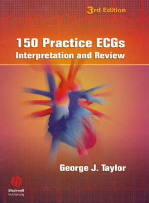 150 Practice ECGs - Interpretation and Review 3e
