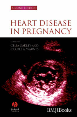 Heart Disease in Pregnancy 2e
