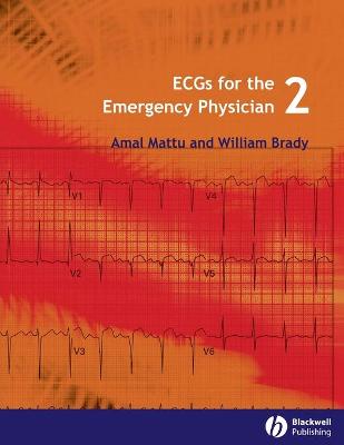 ECGs for the Emergency Physician 2e