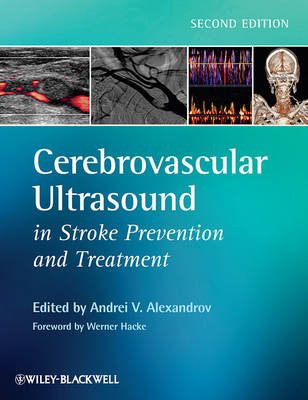 Cerebrovascular Ultrasound in Stroke Prevention and Treatment 2e