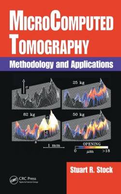 MicroComputed Tomography